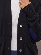 Close-up of button placket and ribbed texture, detail view.